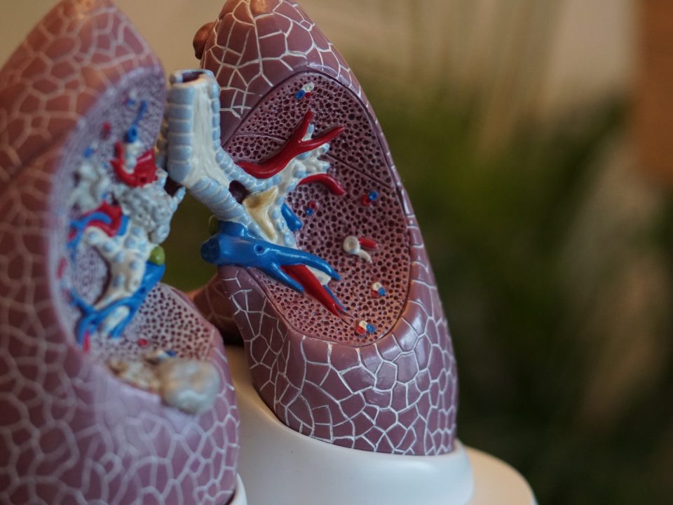 lung cancer